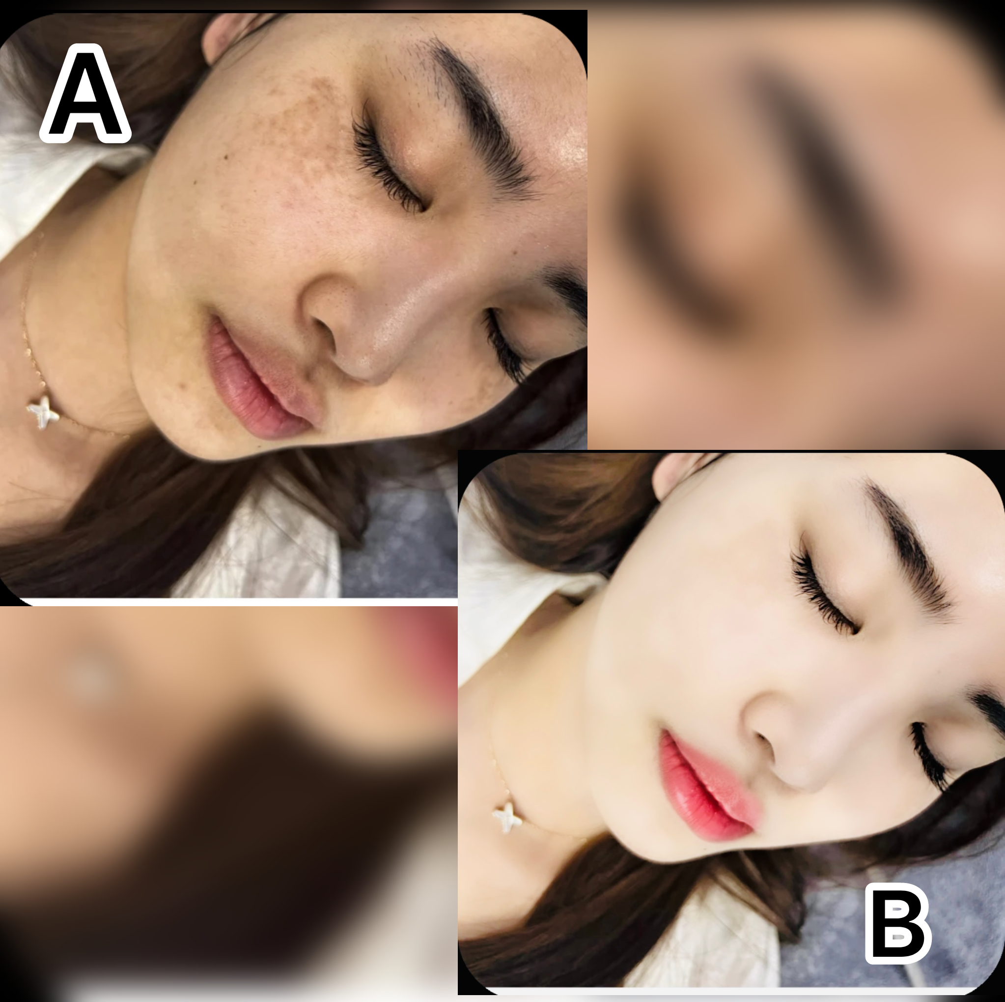 Face Cleaning and Whitening ( XUEROUYAR )